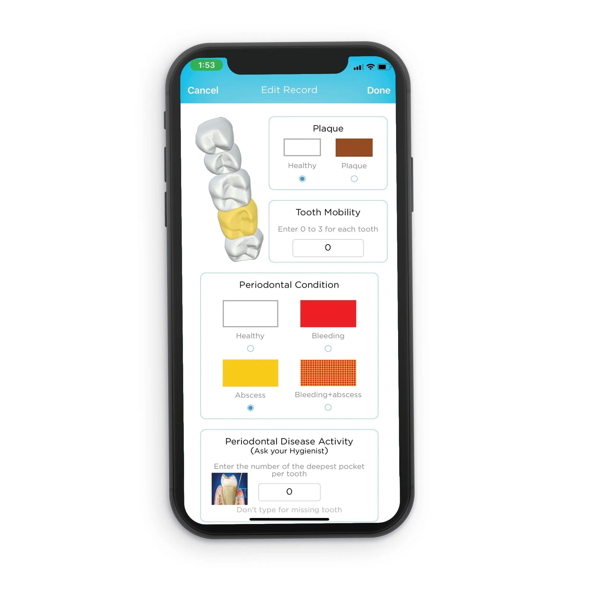 Blu Smart Toothbrush